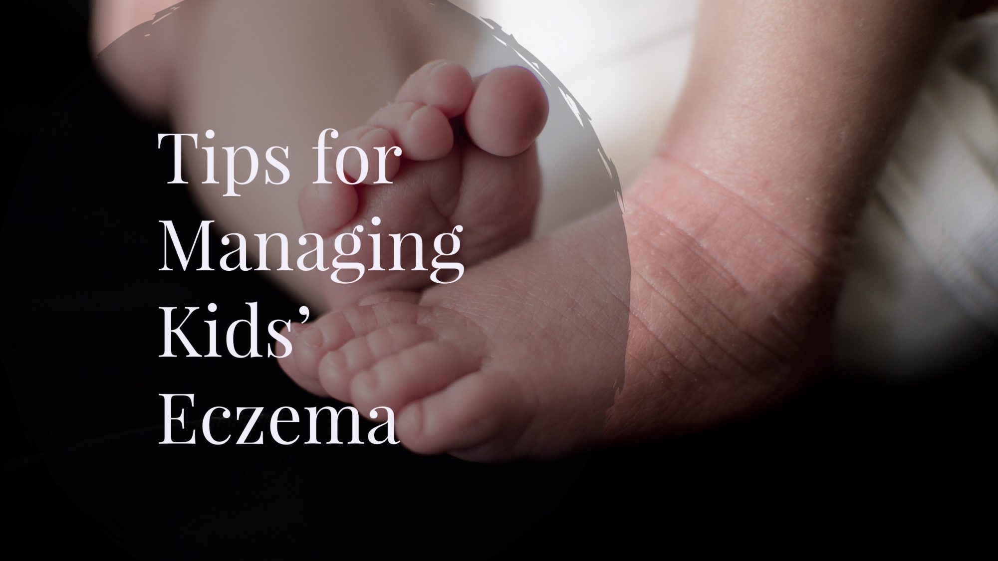 Tips for Managing Baby and Toddler Eczema – Bash & Co. • bellybrief